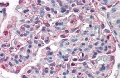 Immunohistochemistry-Paraffin: SLC39A14 Antibody [NBP3-14473]